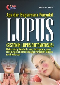 Image of Apa dan Bagaimana Lupus (Sistematik Lupus Eritematosus): Makna Hidup Penderita yang Terdiagnosa Lupus Eritematosus Sistemik dengan Perspektif Maslow dan Henderson